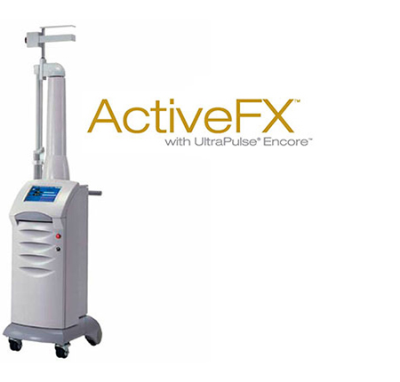 Active FX
